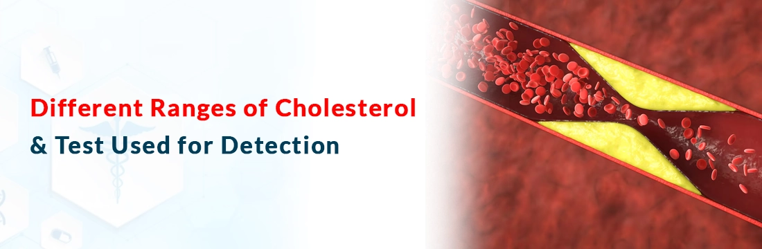 Different Ranges of Cholesterol & Test Used for Detection
